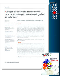 Read more about the article Retentores intrarradiculares.
