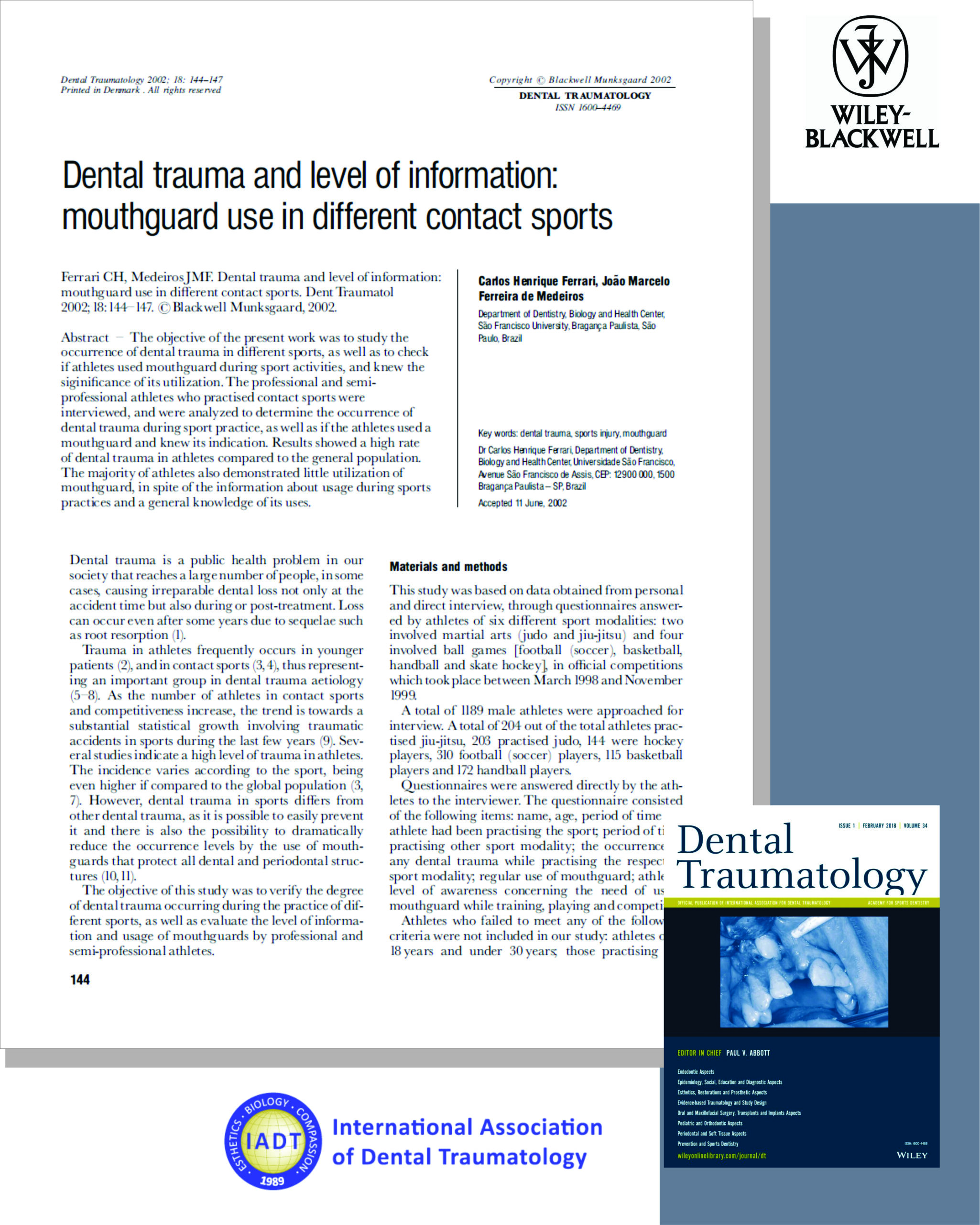 You are currently viewing Dental Trauma. Published work.