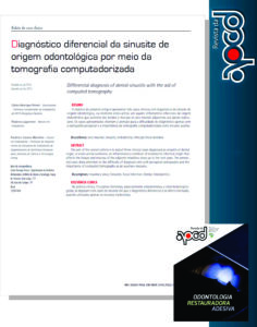 Read more about the article Sinusite de origem odontológica.