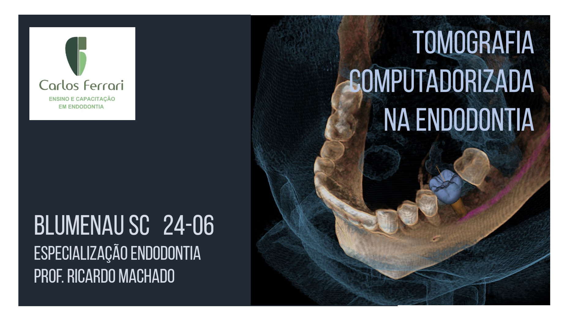 您目前正在查看牙髓病学的断层扫描课程。Blumenau SC.