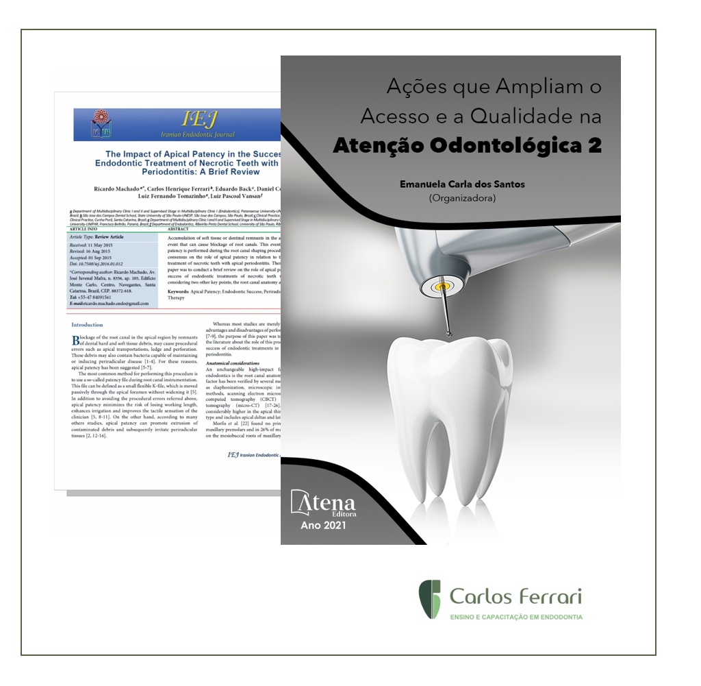 Read more about the article Artigo citado no livro: Ações que Ampliam o Acesso e a Qualidade na Atenção Odontológica 2