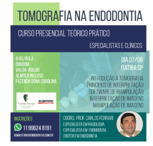 Read more about the article Curso de tomografia na endodontia