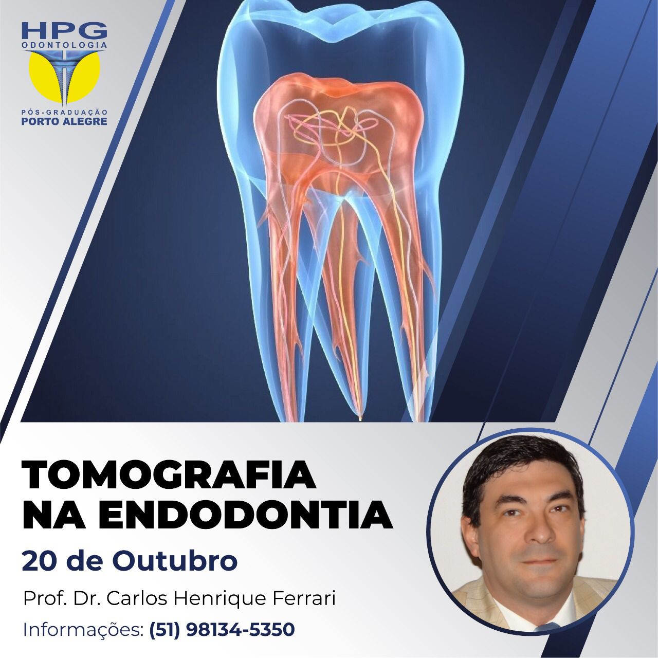 You are currently viewing Tomografia cone beam na Endodontia, presencial em Porto Alegre.