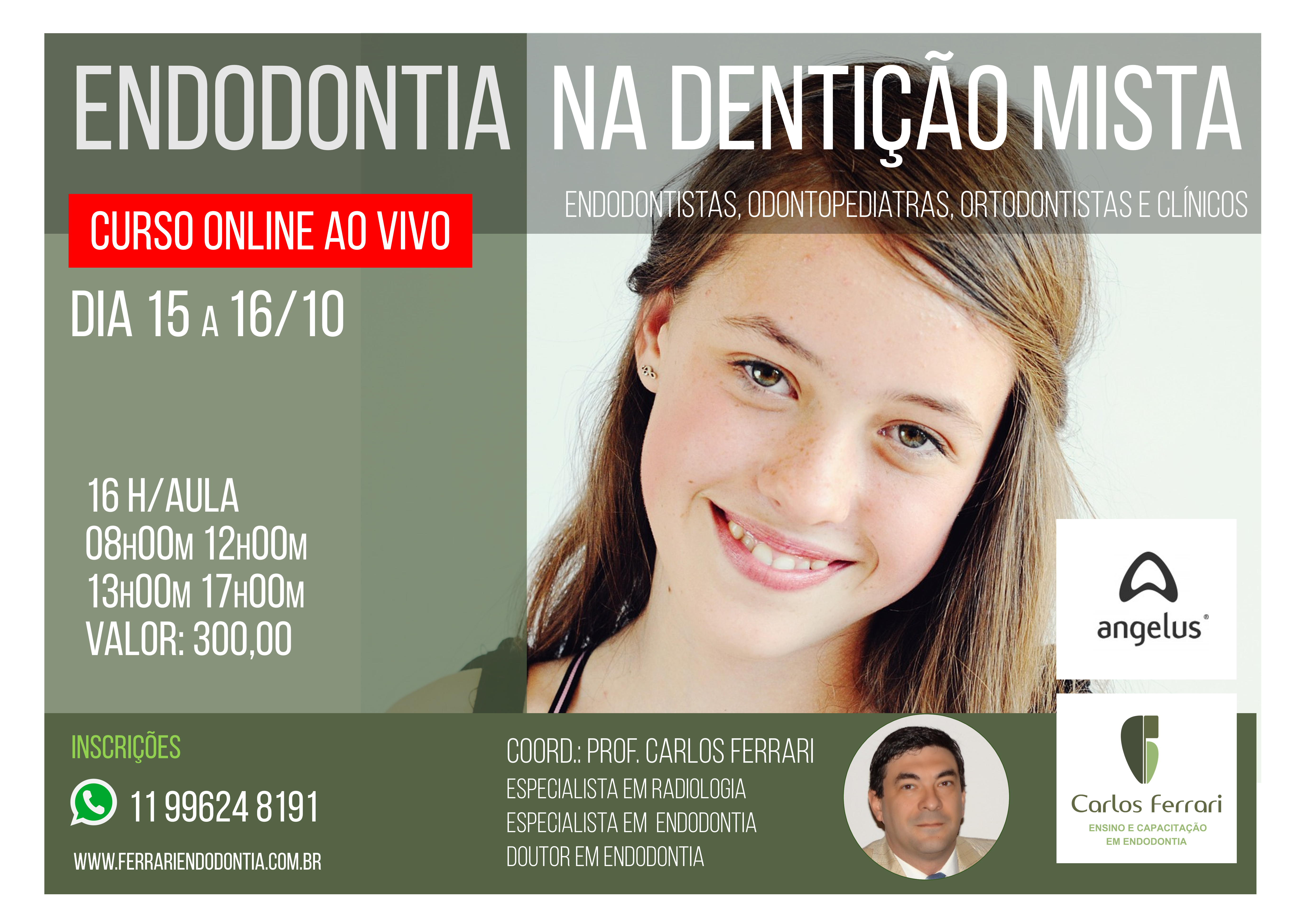 You are currently viewing Curso online. Endodontia na dentição mista.