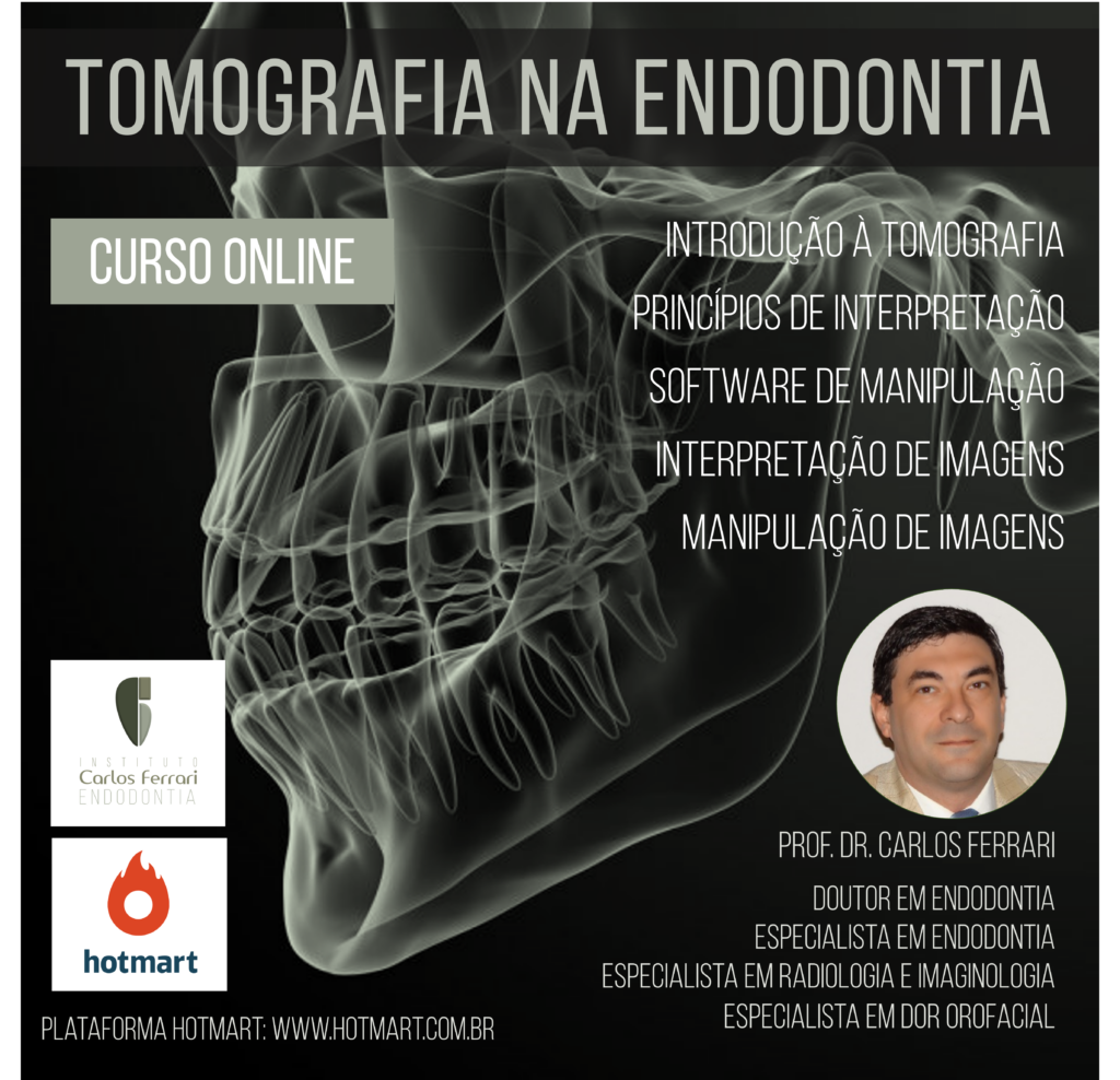 Read more about the article Tomografia na endodontia. Curso online.