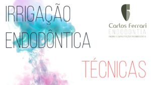 Read more about the article Técnicas de irrigação na endodontia. 2a parte. Aula online.