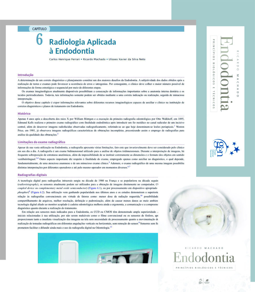 Read more about the article Livro de Endodontia. Capítulo Radiologia Aplicada à Endodontia.