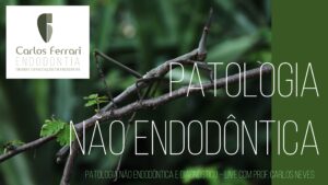 Read more about the article Lesão periapical não endodôntica. Palestra.