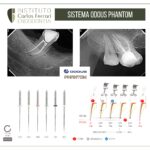Odous Phantom file.Rotatory endodontic preparation system.