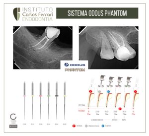Read more about the article Lima Odous Phantom.Sistema de preparo endodôntico rotatório.