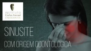 Leer más sobre el artículo Sinusitis odontogénica. Conferencia en línea.