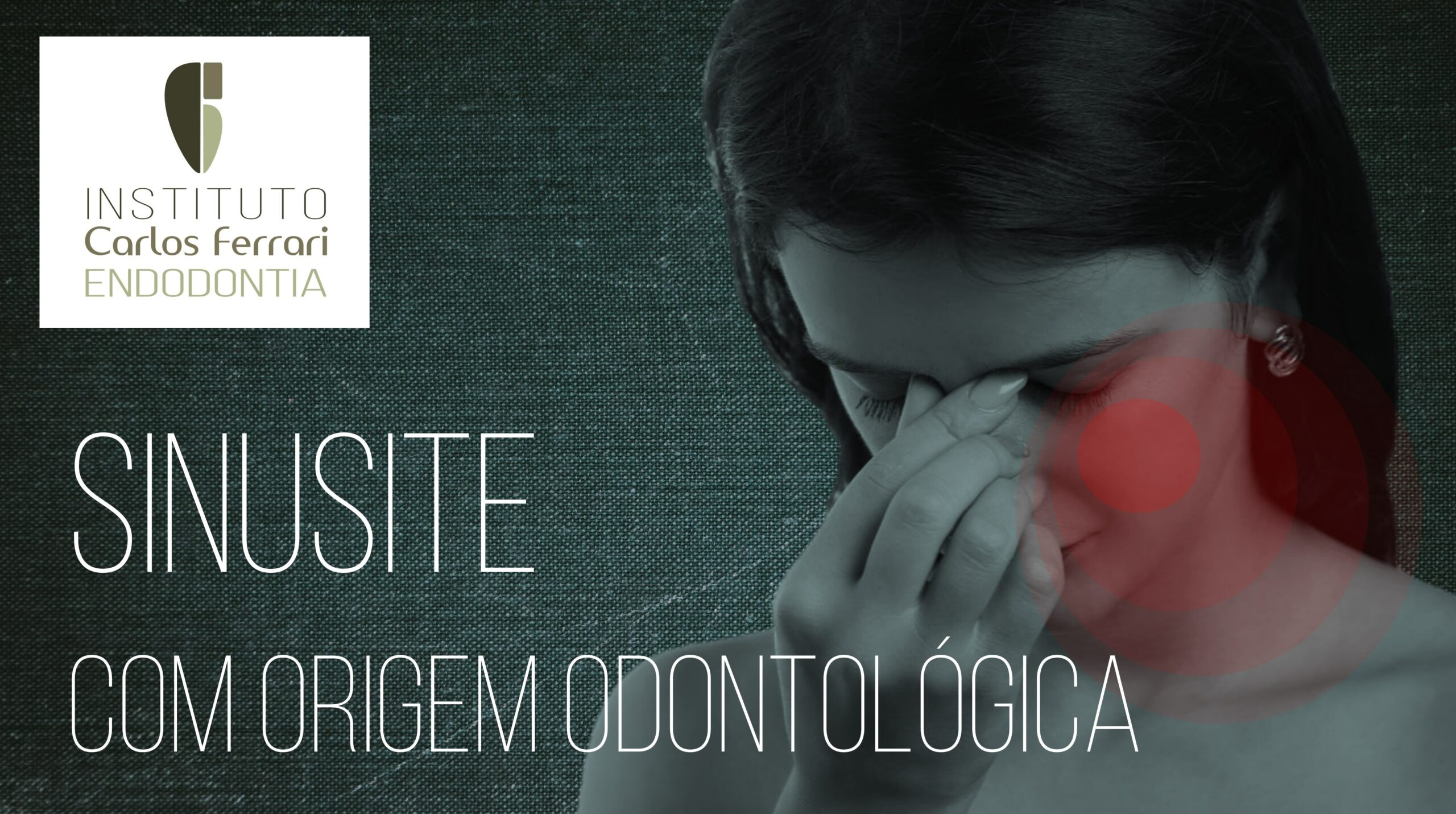 You are currently viewing Sinusite odontogênica. Palestra online.