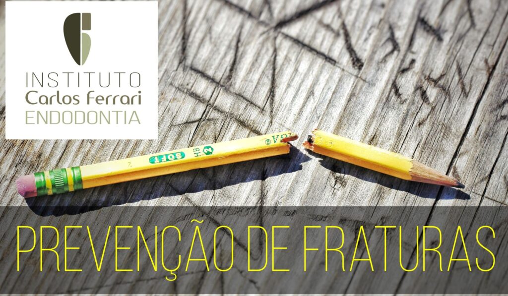 Read more about the article Fratura do instrumento endodôntico. Guia de Prevenção. Aula Online.