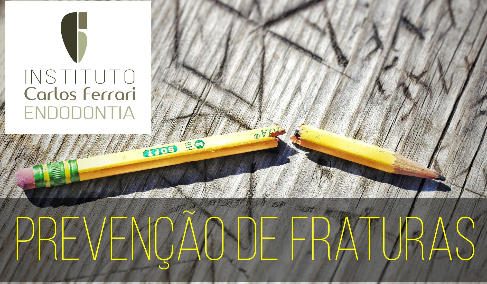 You are currently viewing Fratura do instrumento endodôntico. Guia de Prevenção. Aula Online.