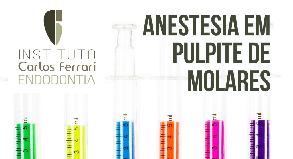Read more about the article Anestesia em pulpite de molares.