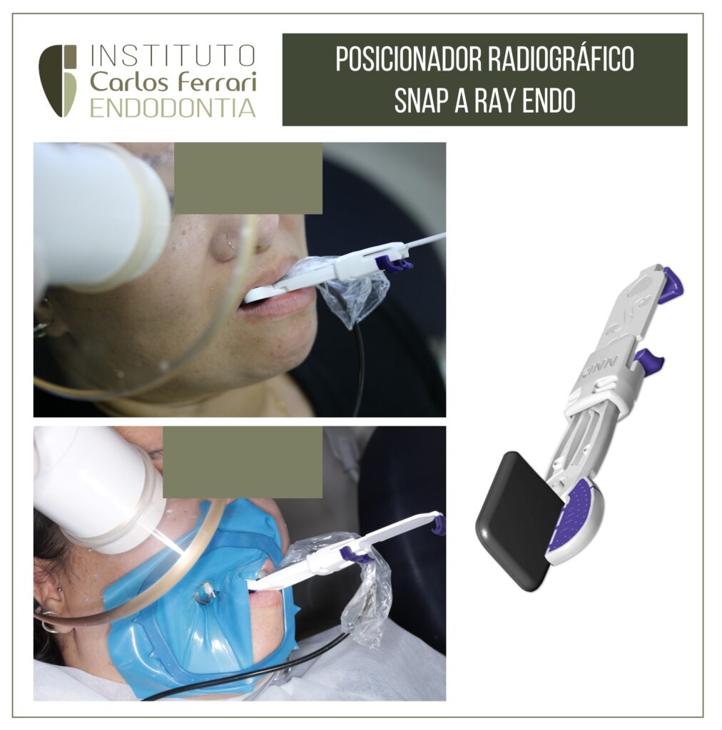 Read more about the article Radiographic positioner for endodontics.