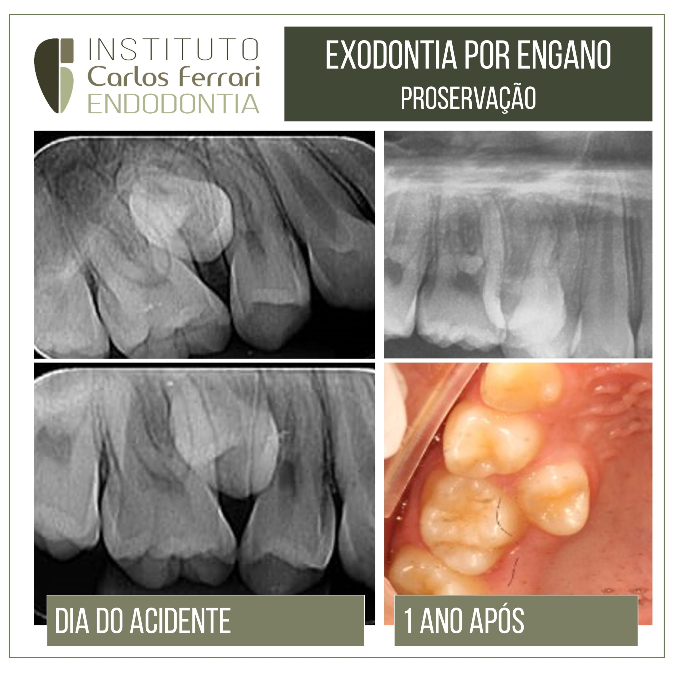 您正在错误地查看 Exodontia。保存。