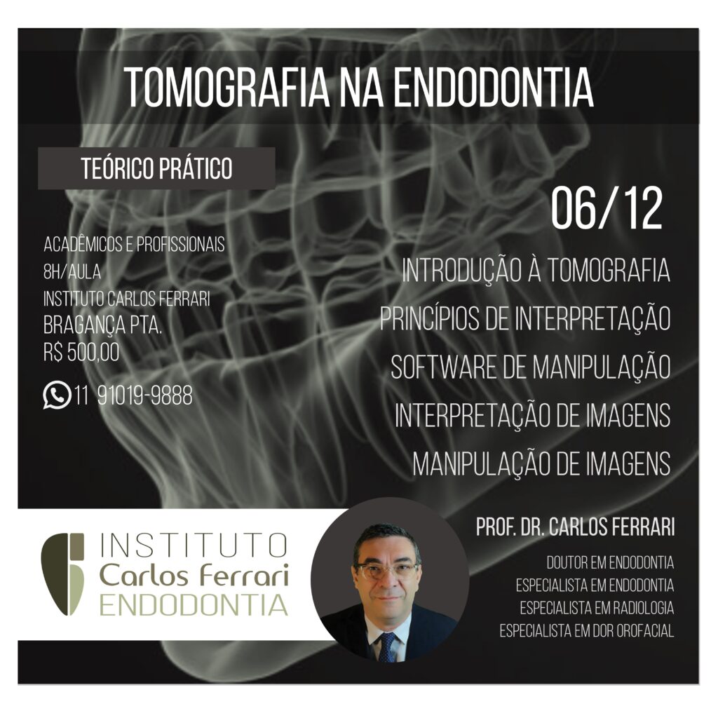 Read more about the article Tomografia na endodontia. Curso presencial.