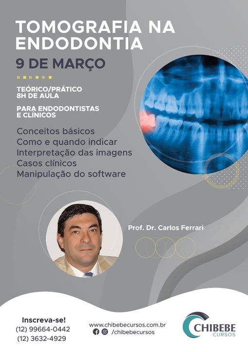 Curso de tomografia na endodontia. Chibebe Cursos. Taubaté SP.