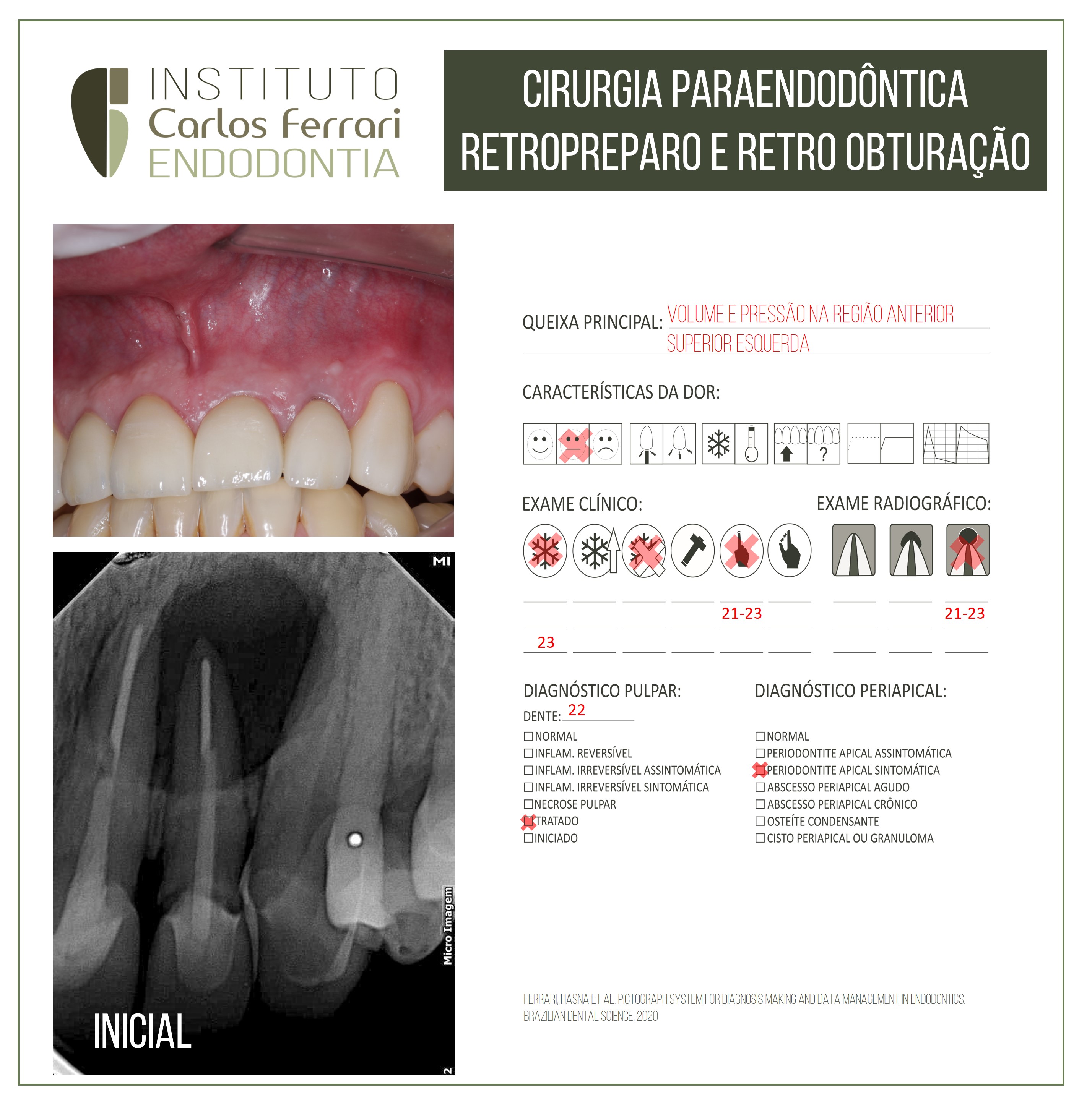 Cirurgia paraendodôntica retropreparo.