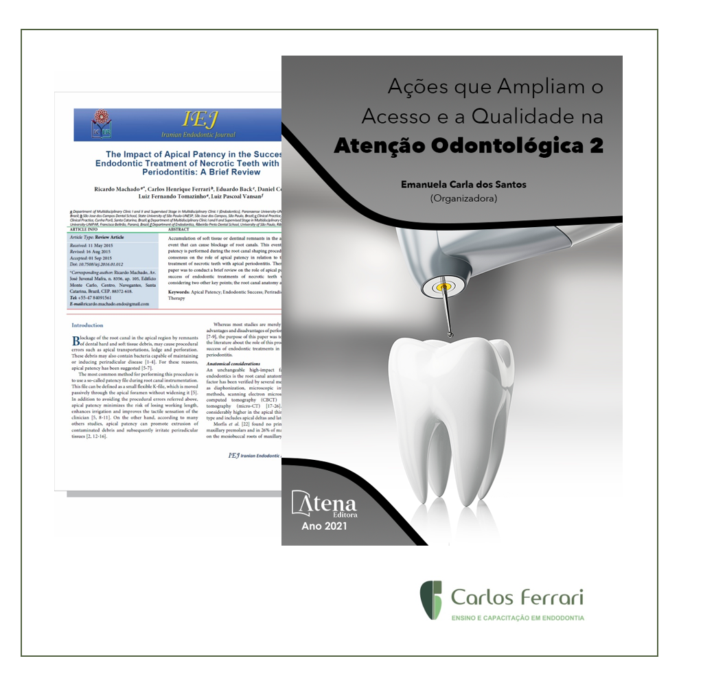 Artigo citado no livro: Ações que Ampliam o Acesso e a Qualidade na Atenção Odontológica 2