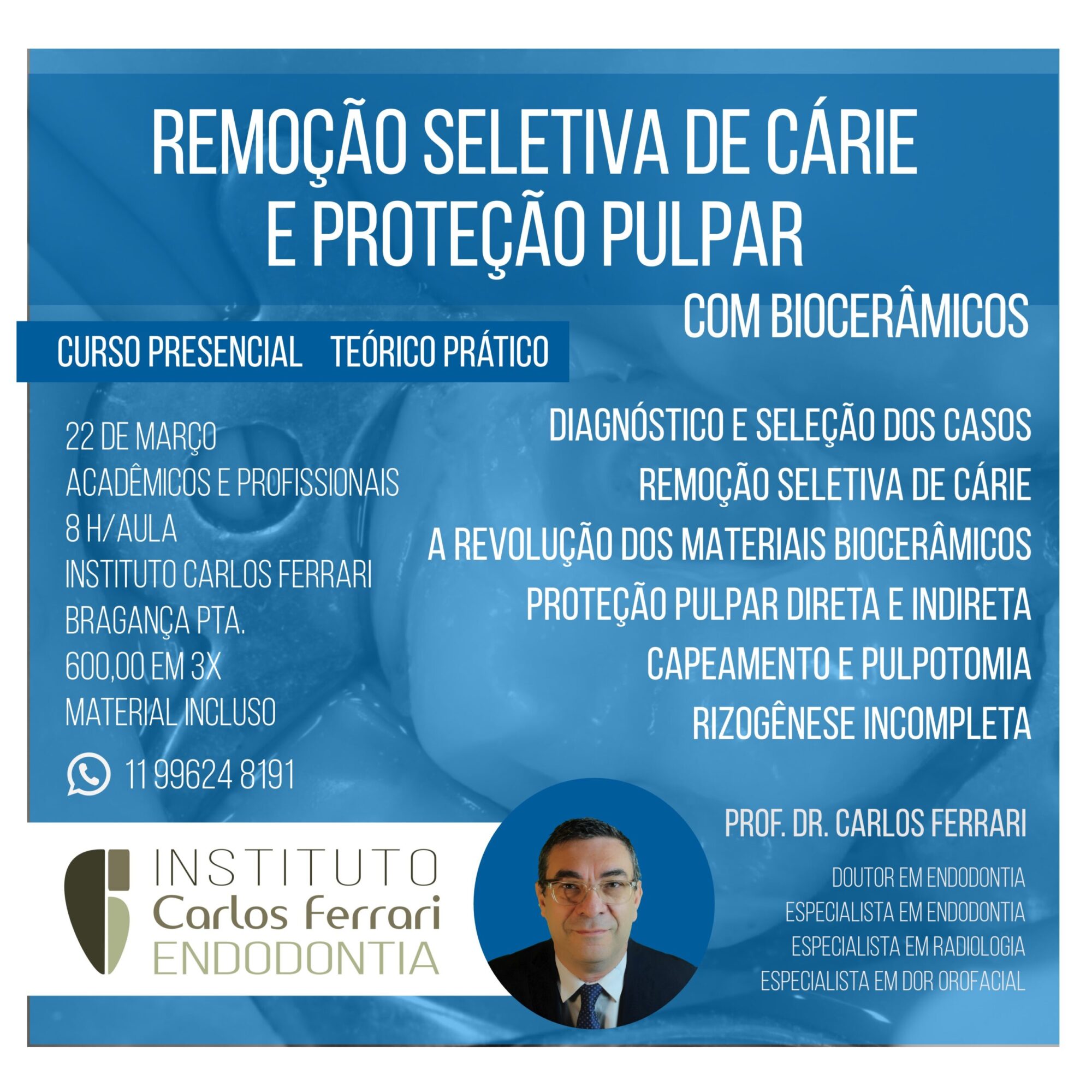 Curso remoção seletiva de cárie e proteção da polpa.