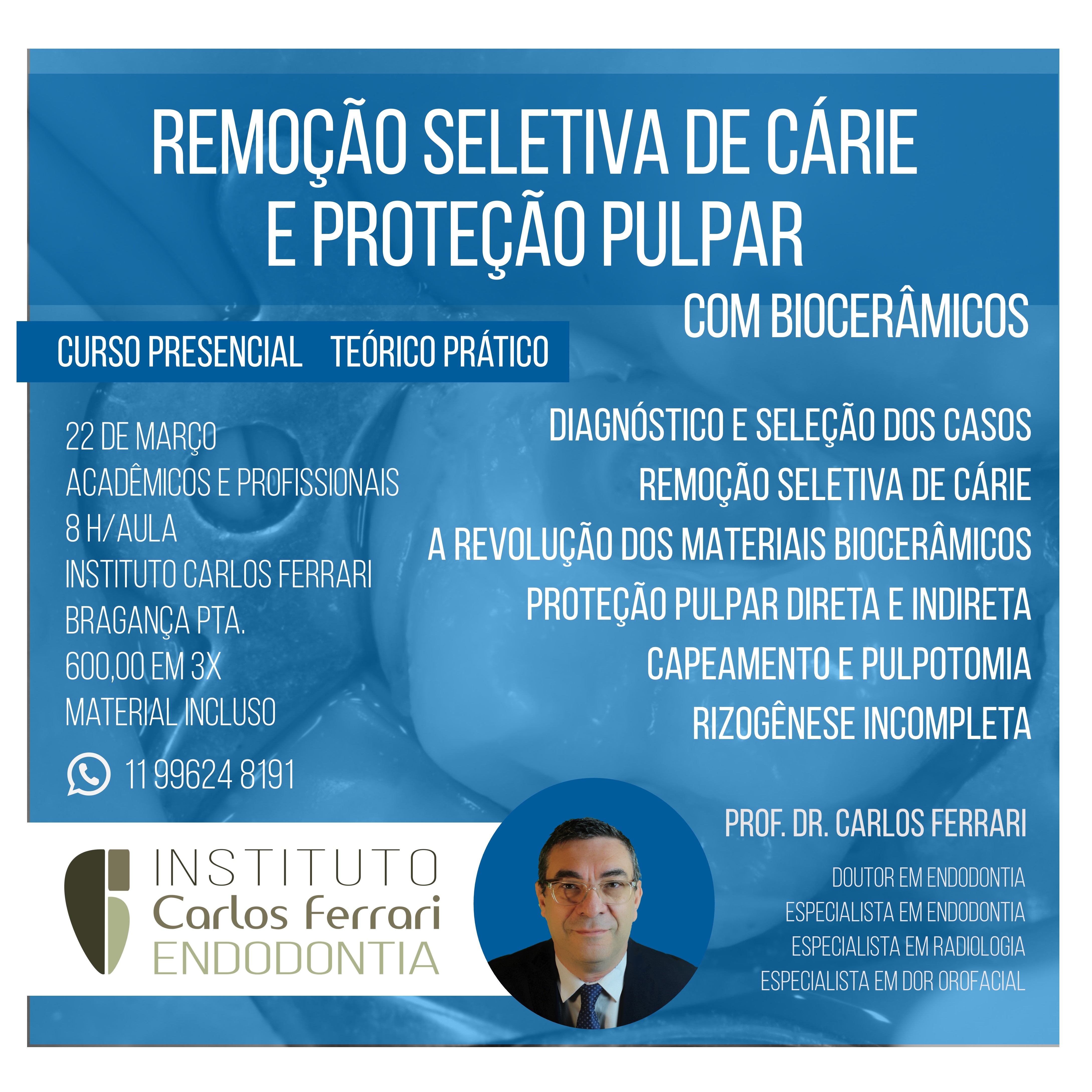 Curso remoção seletiva de cárie e proteção da polpa.