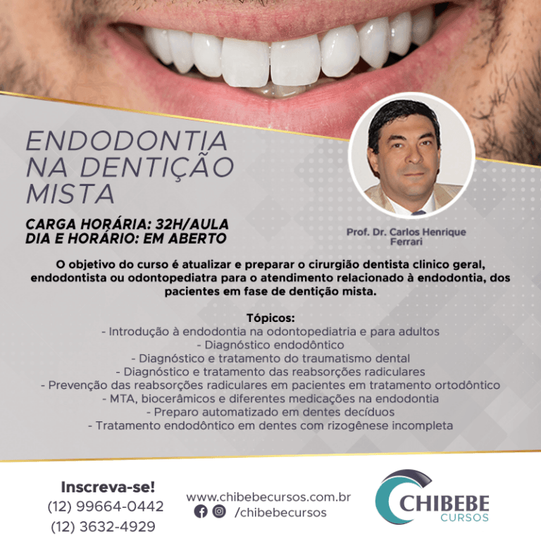 Endodontia-na-denticao-mista