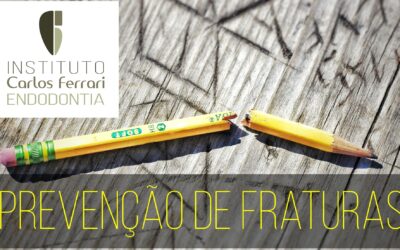 Fratura do instrumento endodôntico. Guia de Prevenção. Aula Online.