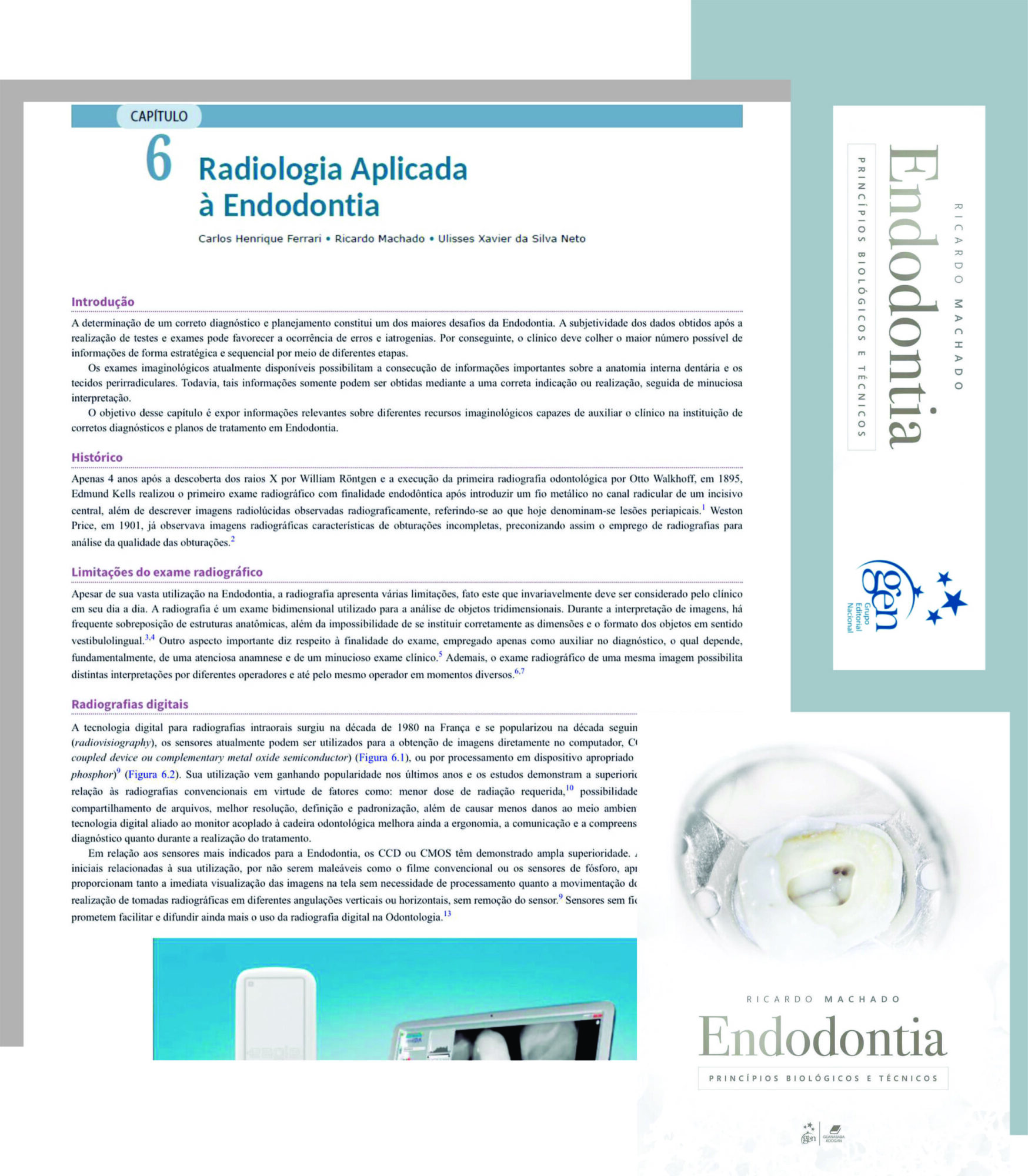 Livro de Endodontia. Capítulo Radiologia Aplicada à Endodontia.