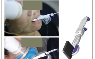 Posicionador radiográfico para endodontia.
