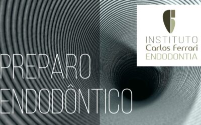 Preparo endodôntico. Conceitos Básicos. Aula Online.