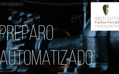 Preparo endodôntico automatizado. Aula online.