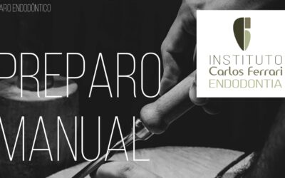 Preparo endodôntico manual.