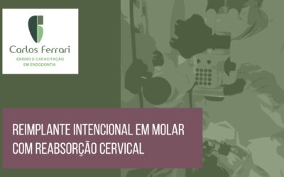 Reabsorção radicular. Reimplante Intencional em reabsorção cervical.