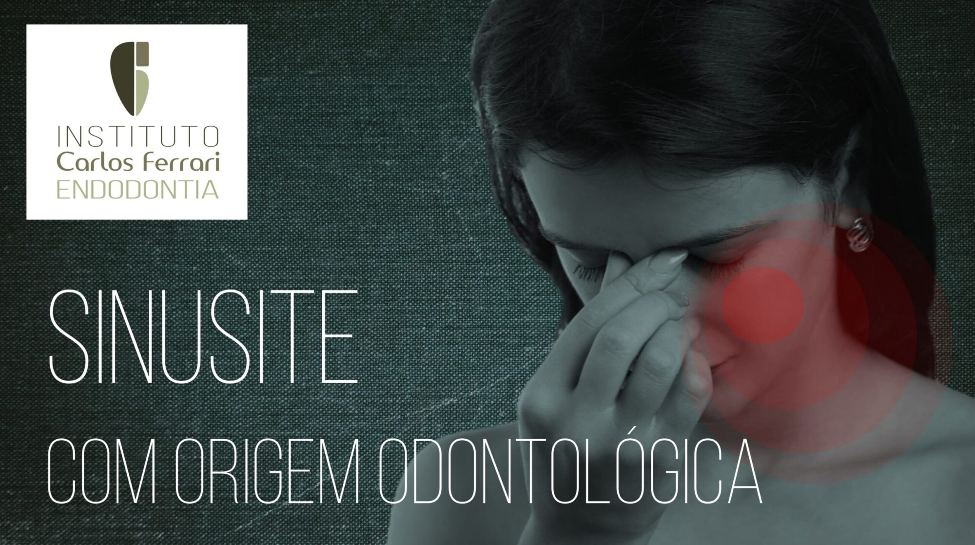 Sinusite odontogênica. Palestra online.