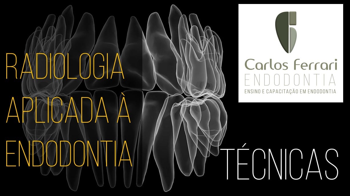Técnica radiográfica na endodontia. 2a parte. Aula Online. Técnica radiográfica na endodontia. 2a parte. Aula Online.