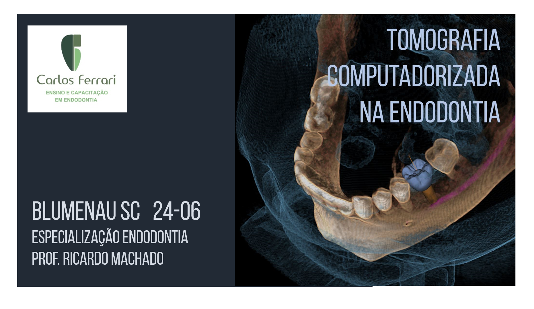 Curso de Tomografia na Endodontia. Blumenau SC.