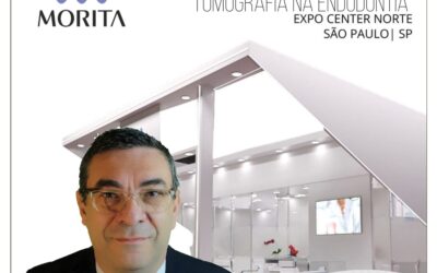 Tomografia cone beam na endodontia