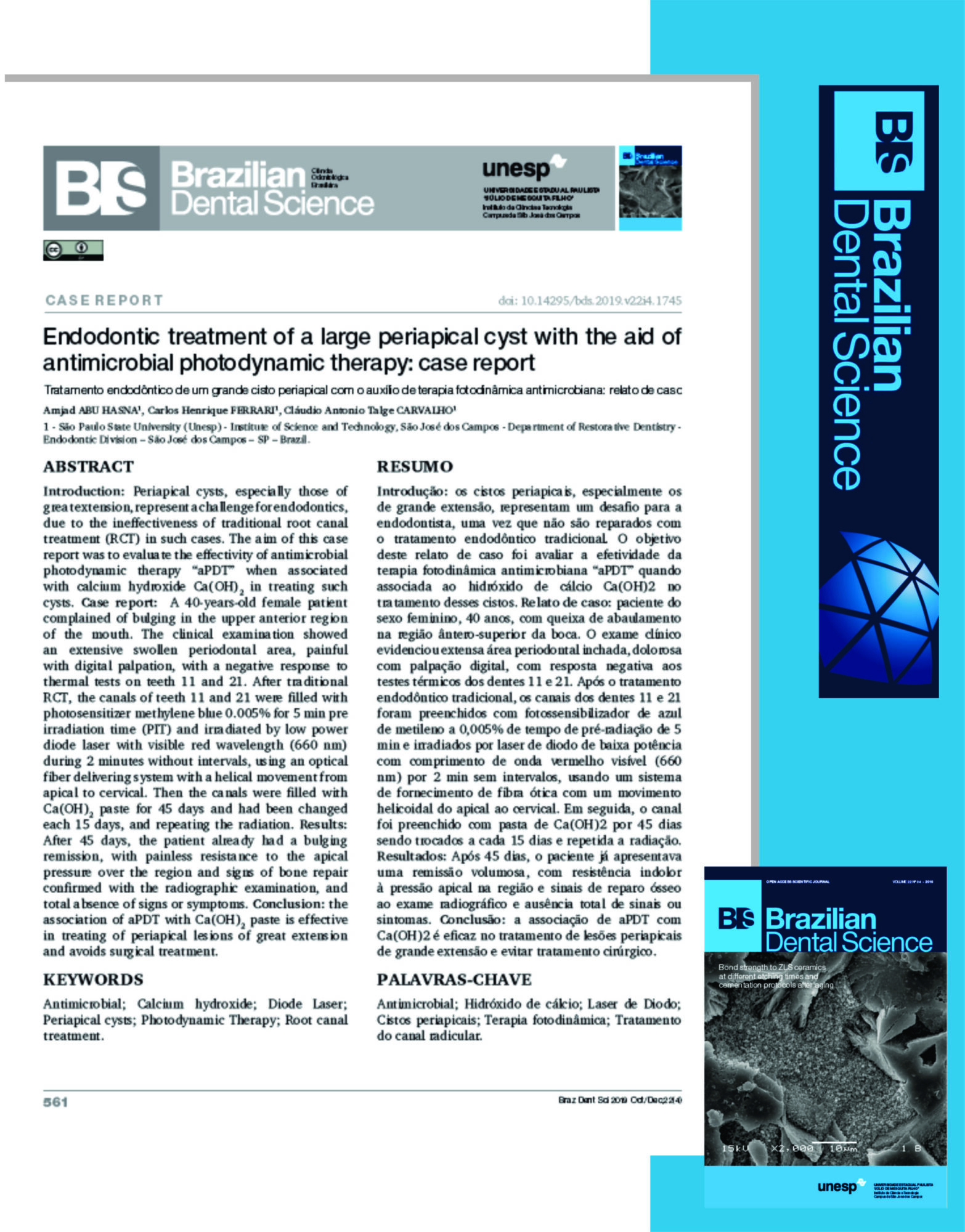 Cisto periapical. Endodontic treatment of a large periapical cyst with the aid of antimicrobial photodynamic therapy: case report