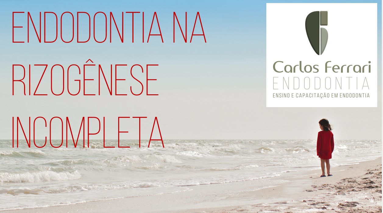 Endodontia na rizogênese incompleta. 1a parte. Aula online.