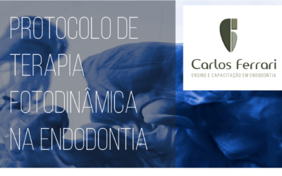 Terapia fotodinâmica na endodontia. Protocolo.