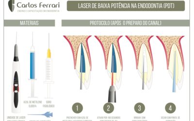 Terapia fotodinâmica na endodontia. Guia de utilização.