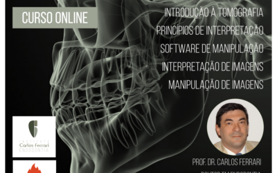 Tomografia na endodontia. Curso online.