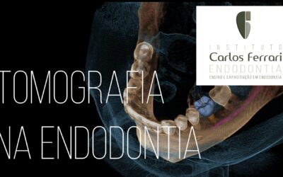 Tomografia na endodontia. Introdução. Aula online.
