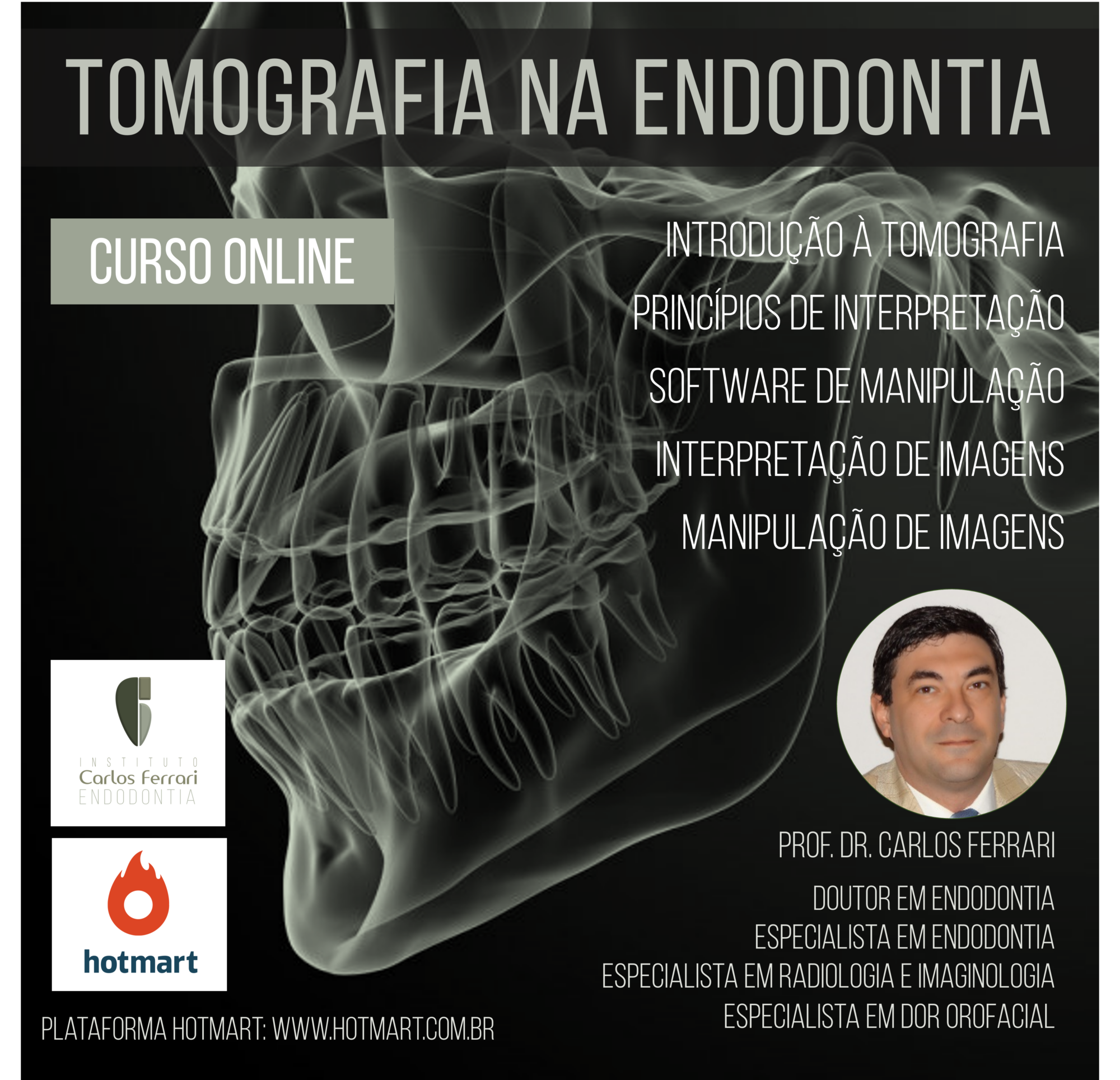 Tomografia na endodontia. Curso online.