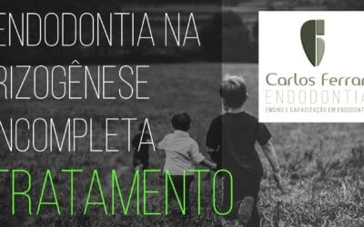 Tratamento endodôntico na rizogênese incompleta. 2a. parte. Aula Online.